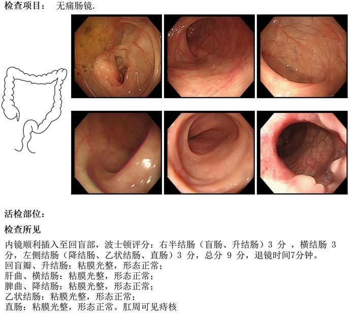 术前肠镜影像
